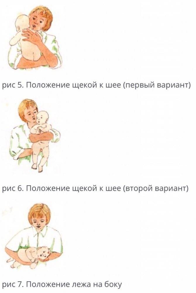 Кривошея у ребенка - признаки, причины, симптомы, лечение и профилактика - idoctor.kz