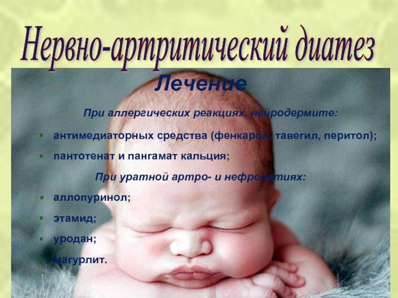 Диатез у детей разных возрастов: симптомы, лечение, диета