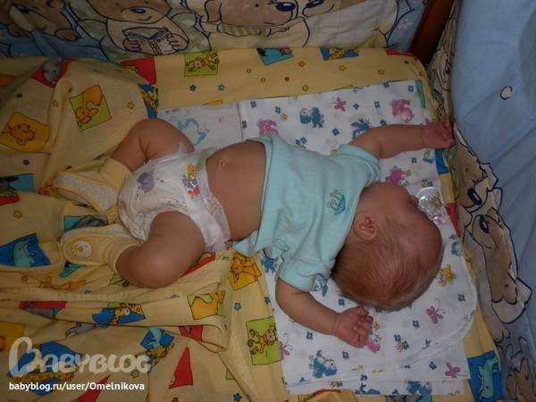 В первые за 7 месяцев. Новорожденный ребенок закидывает голову назад. Запрокидывание головы у грудничка. Гипертонус спины у грудничков. Запрокидывание головы назад у грудничка.