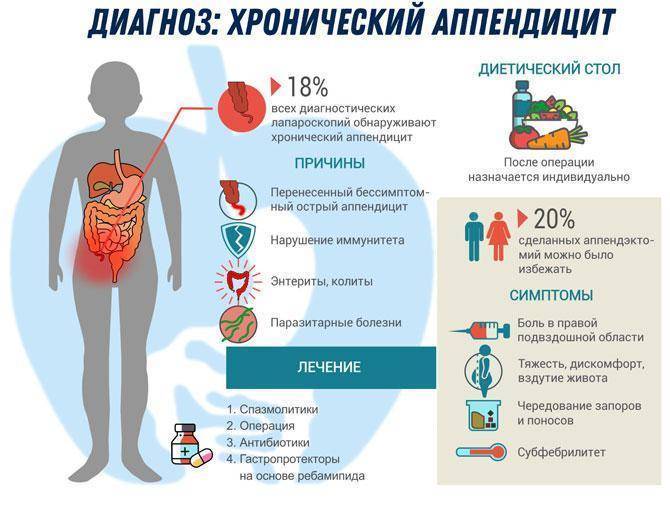 Боль в районе аппендицита