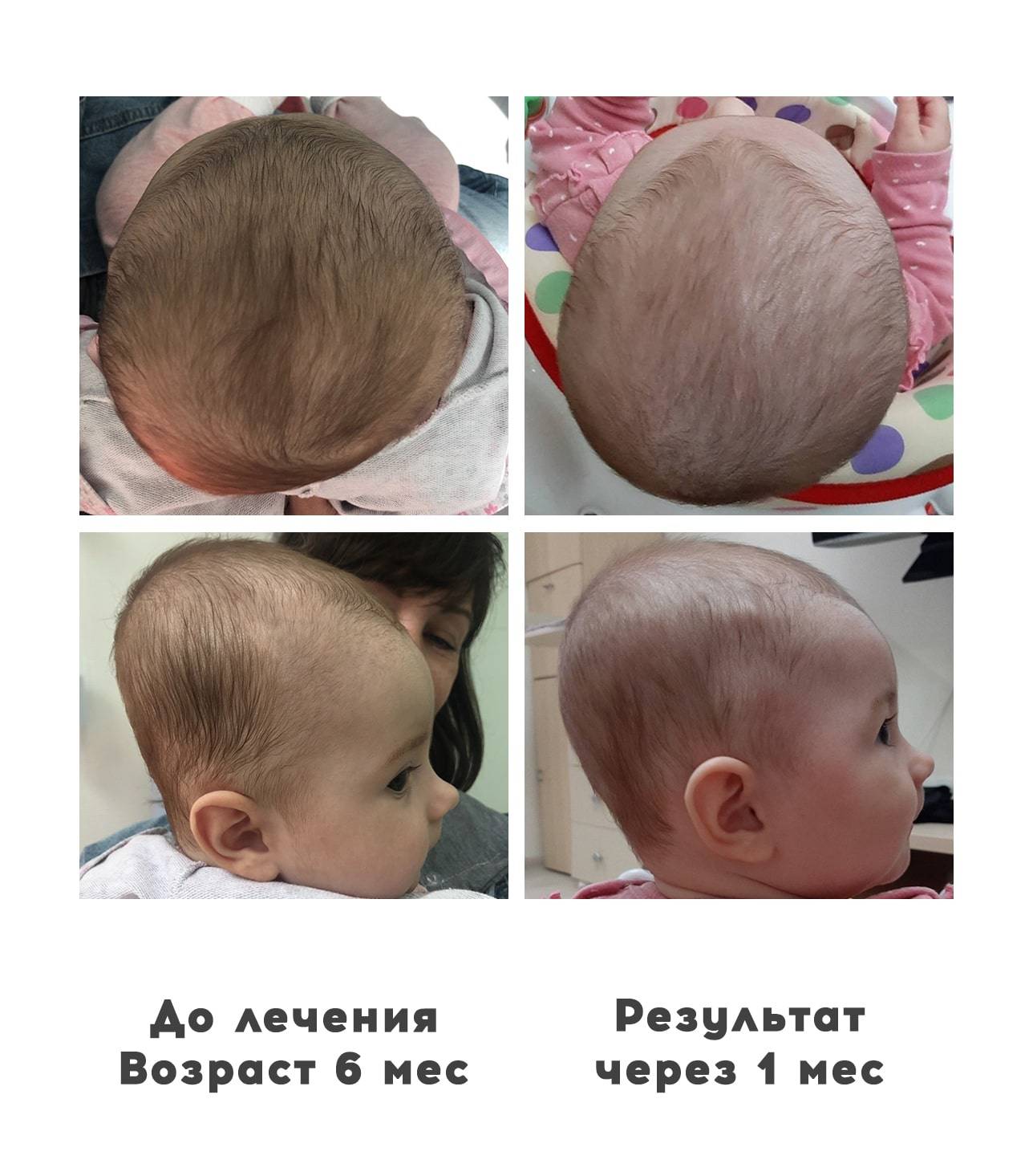 До какого возраста формируется череп у младенца - детская городская поликлиника №1 г. магнитогорска