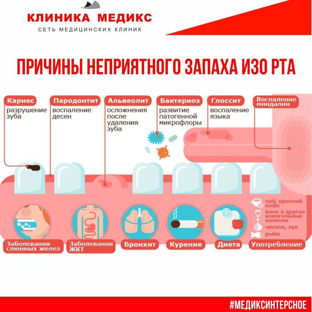Запах изо рта у ребенка — почему