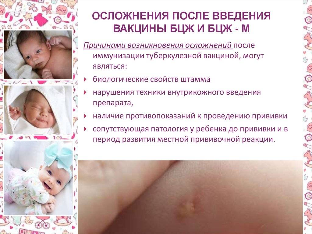 Прививка бцж новорожденным: от чего делают, как протекает, и какая должна быть реакция?