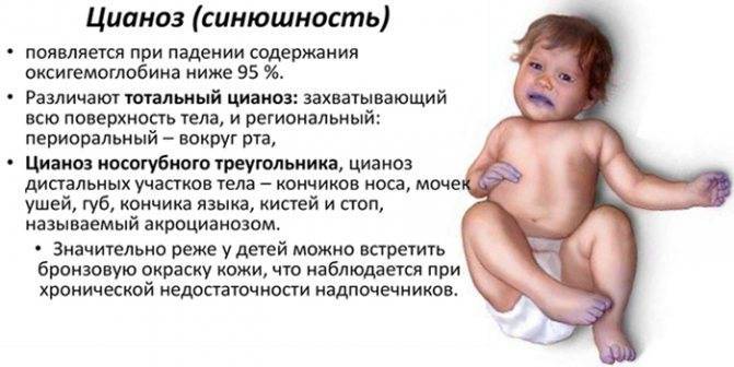 Носогубный треугольник синий у ребенка – причины, диагностика, лечение