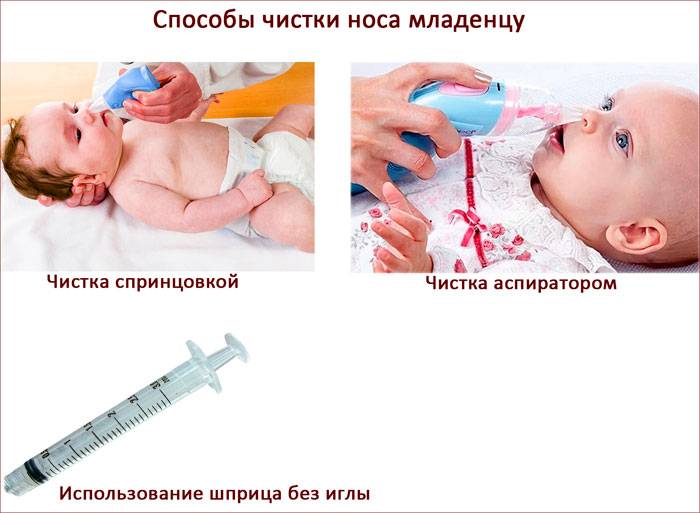 Как правильно отсосать сопли у грудничка аспиратором в домашних условиях