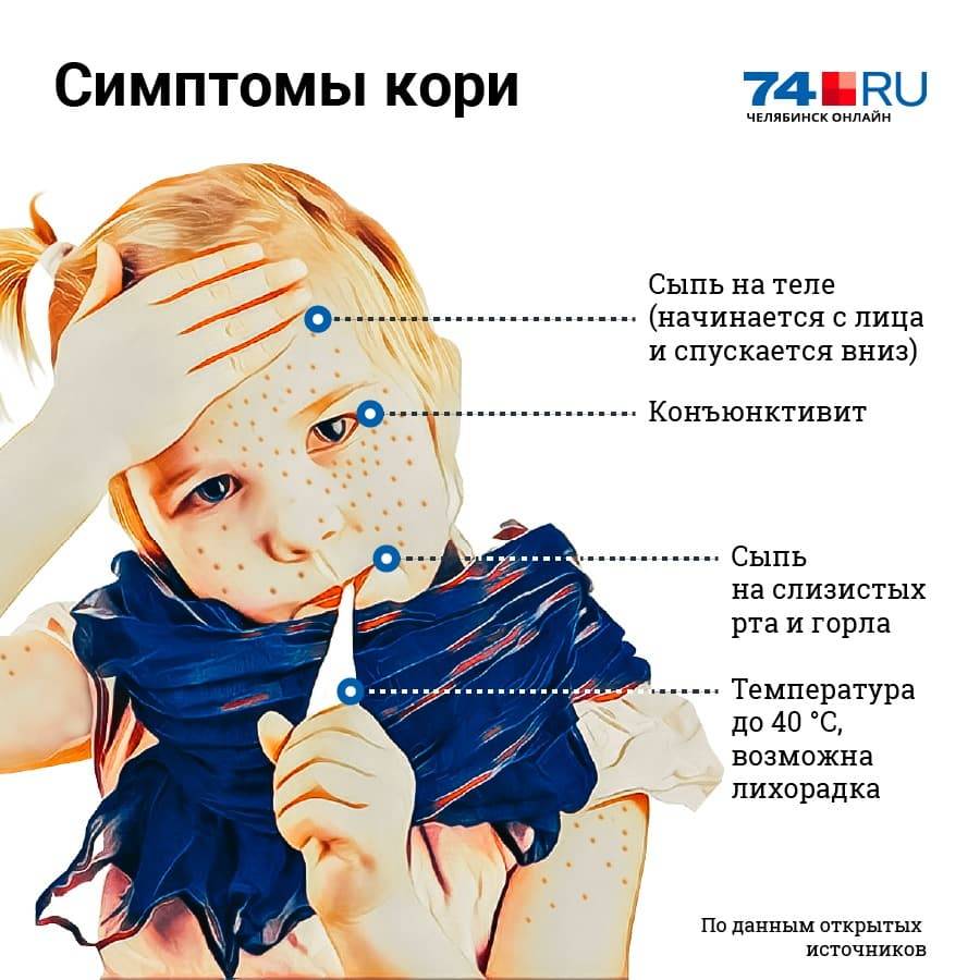 Корь у детей - симптомы болезни, профилактика и лечение кори у детей, причины заболевания и его диагностика на eurolab