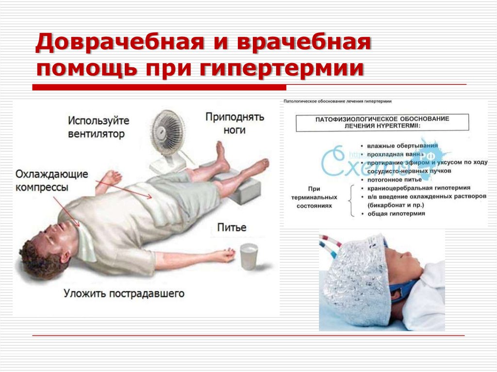 Что делать, если при температуре у ребенка холодные руки и ноги