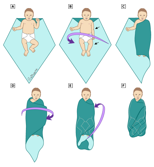 Алгоритм действия пеленания. Как правильно пеленать новорожденного ребенка. Схема пеленания новорожденного в пеленку. Учимся пеленать новорожденного. Как правильно пеленать новорожденного.