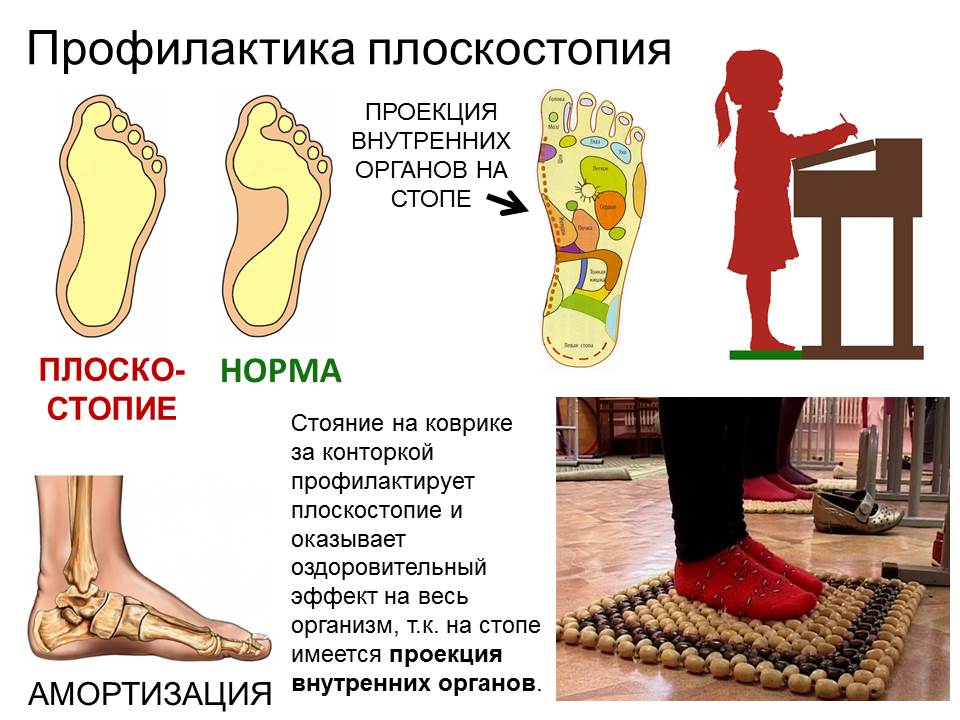 Практикум «профилактика плоскостопия  средствами физической культуры» | дошкольное образование  | современный урок