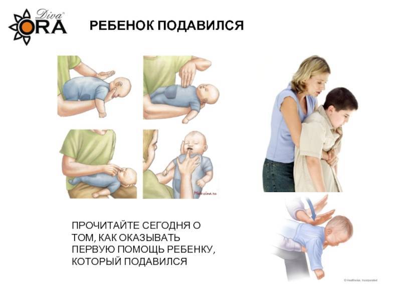 Что делать если грудничок подавился грудным молоком и первая помощь новорожденному ребенку при захлебывании