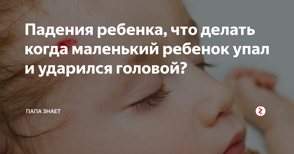 Ударилась головой что делать. Если ребёнок ударился головой. Что делать если ребенок ударился. Ребенок упал и ударился затылком. Ребёнок 6 месяцев ударился головой.