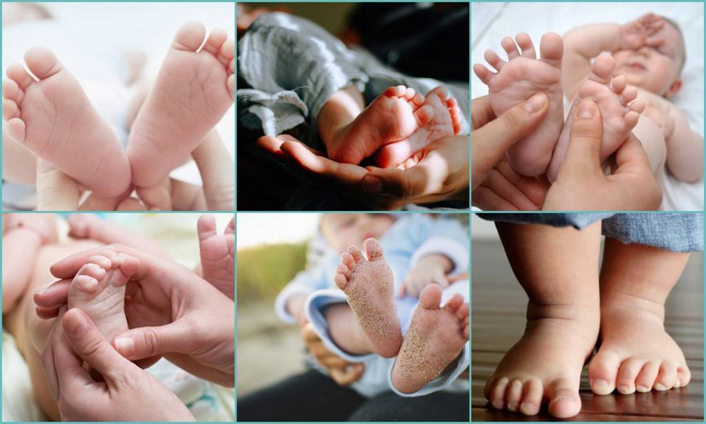 Почему у новорожденного синеют ручки и ножки. неотложная помощь при цианозе новорожденного