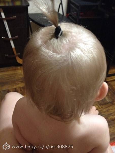 Медленно растут волосы у ребенка | уроки для мам