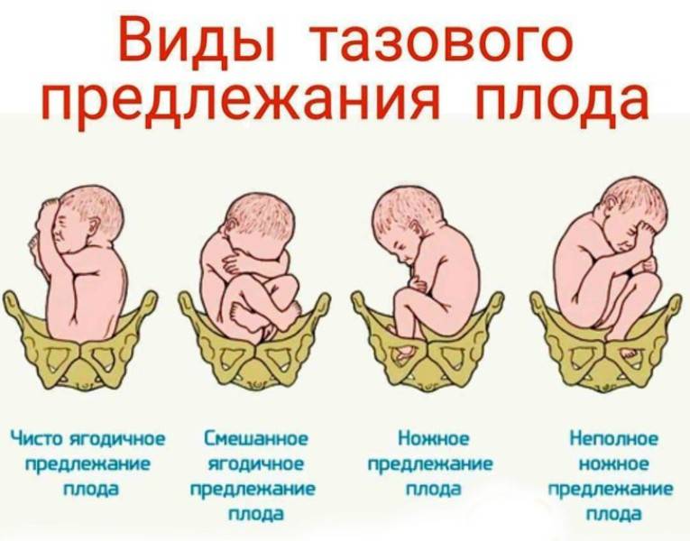 На каком сроке ребенок переворачивается вниз головой: основные нормы :: syl.ru