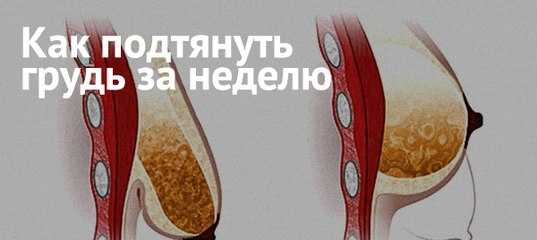 Как подтянуть грудь после кормления: способы и советы