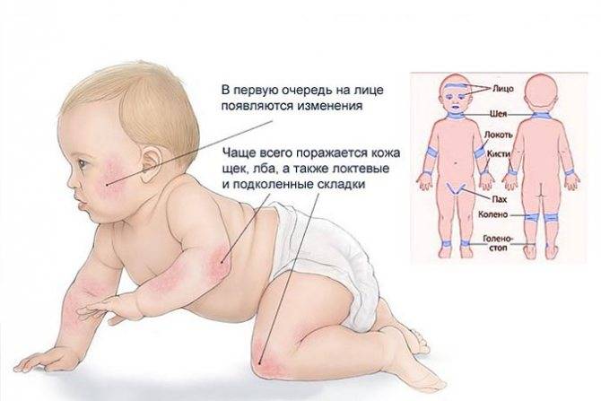 Красная попа у новорожденного | уроки для мам
