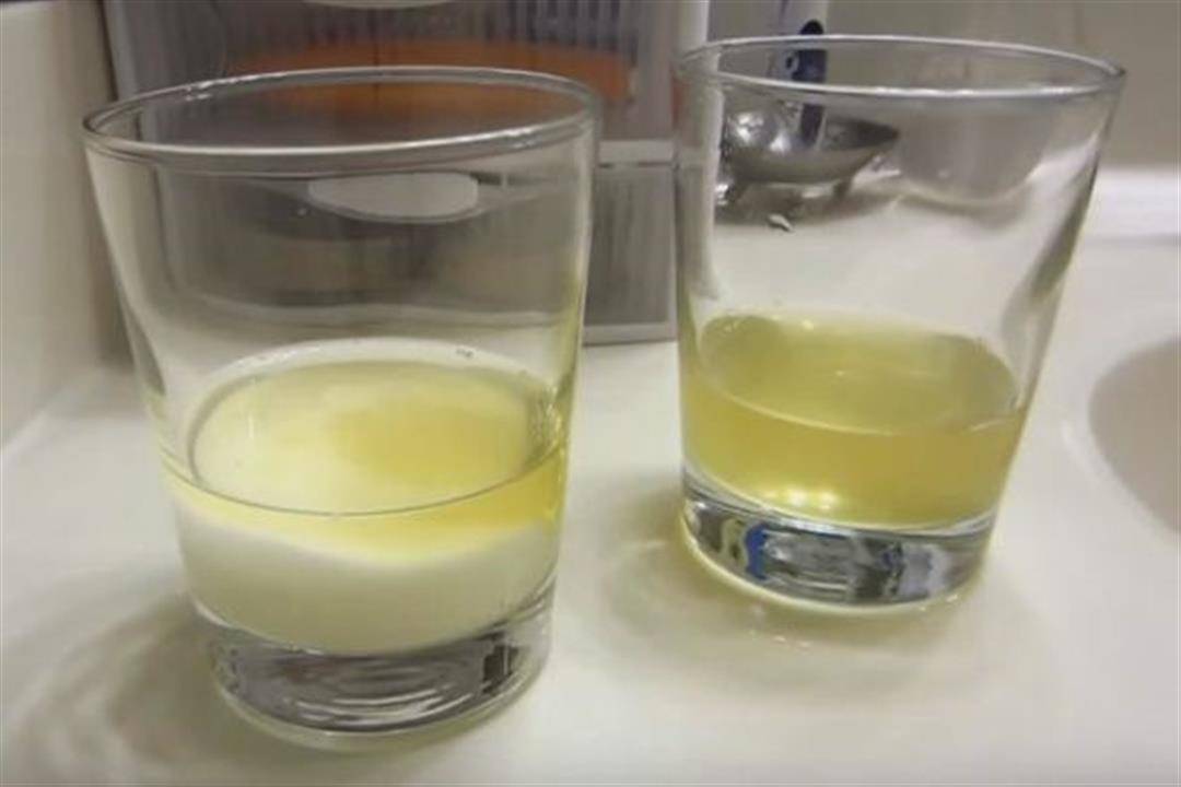 Точный тест на беременность с содой в домашних условях | vetgospital31.ru