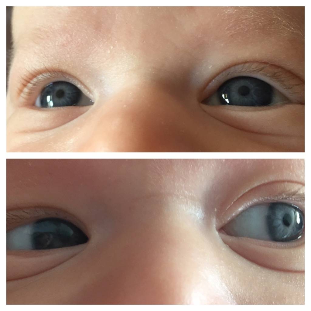 Почему у детей со временем меняется цвет глаз?