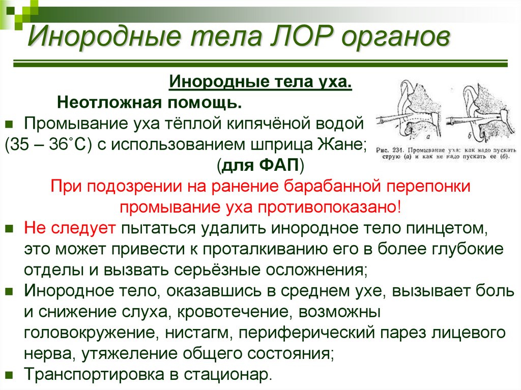 У ребенка в ухе или носу инородное тело – правила первой помощи
