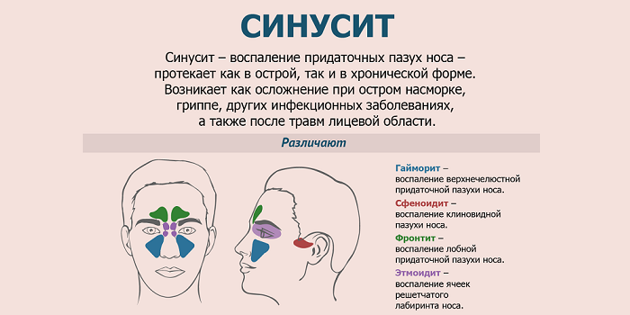 Болит нос при простуде. Болезнь носа синусит симптомы. Лобный синусит симптомы. Гайморит симптомы и синусит симптомы. Синусит фронтит гайморит разница.