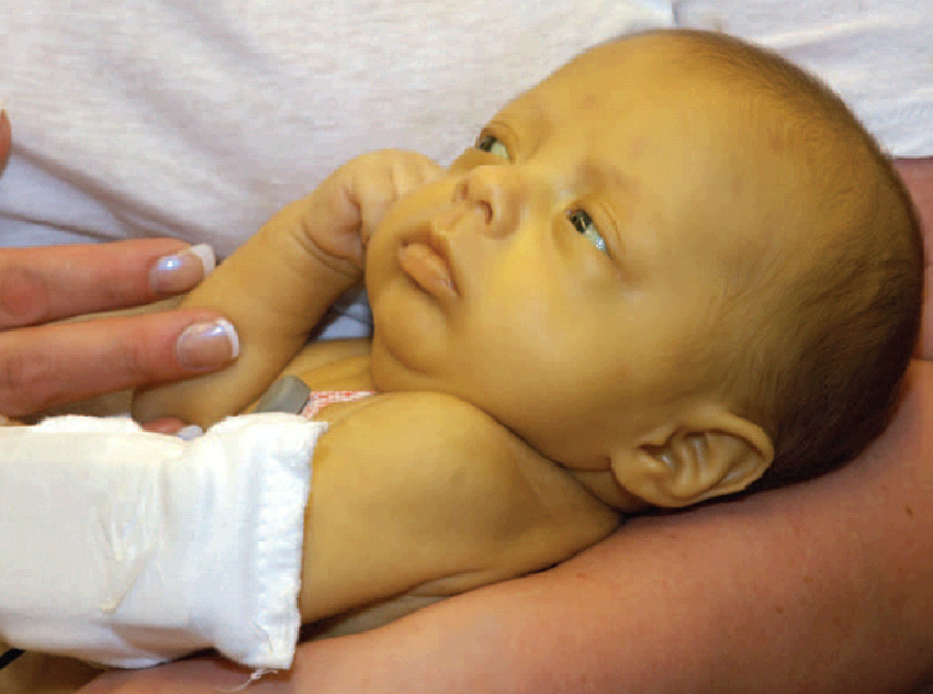 Желтуха у новорожденных: причины и последствия, признаки, когда должна пройти. сколько длится детская желтуха?