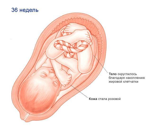 Повышенная температура при беременности | блог | медиацентр