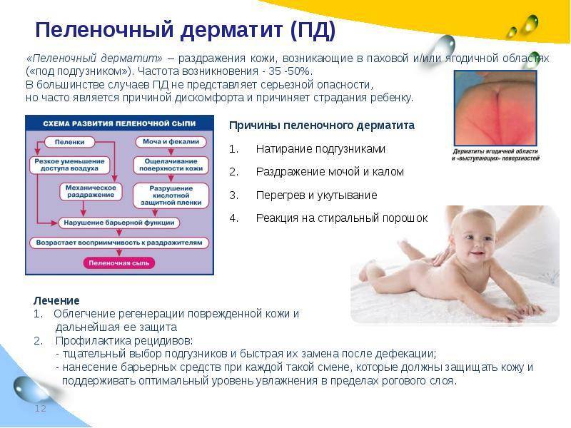 Опрелости у ребенка | медицинский портал eurolab