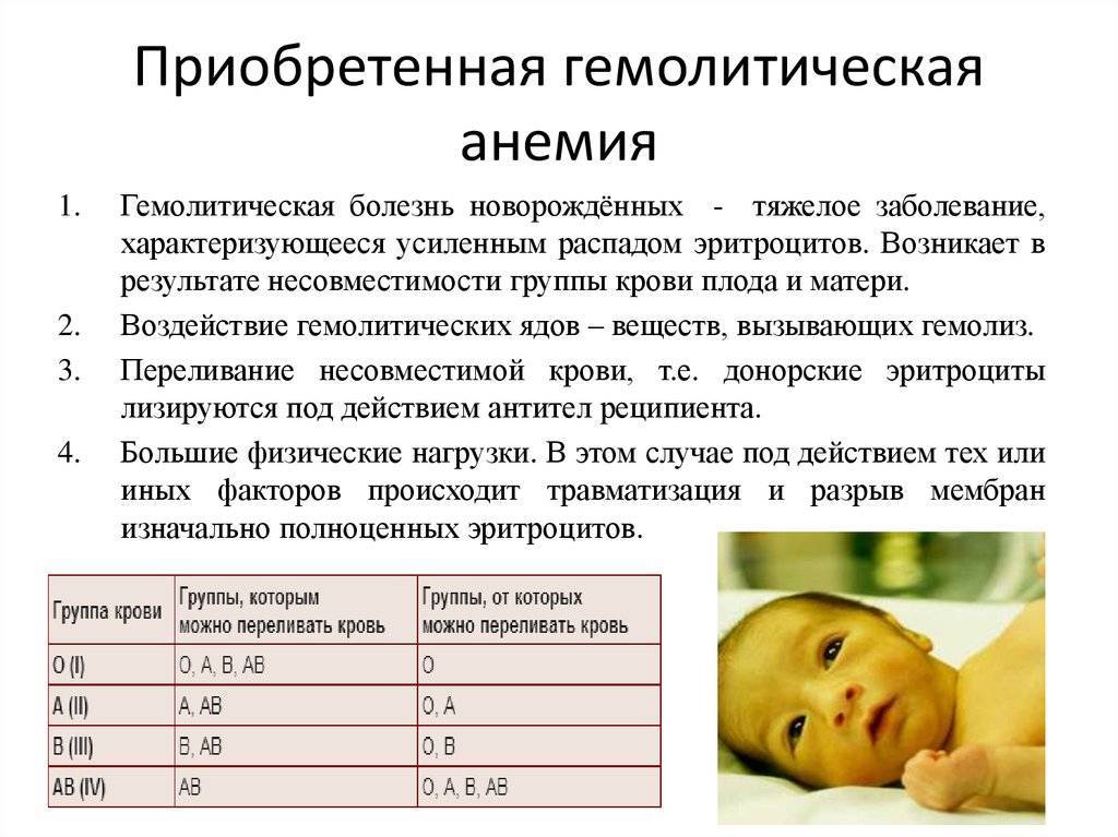 Анемии у детей - симптомы болезни, профилактика и лечение анемий у детей, причины заболевания и его диагностика на eurolab