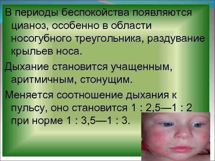 Почему у малыша синеет вокруг рта - детская городская поликлиника №1 г. магнитогорска
