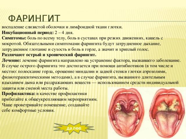 Лечение острого тонзиллита у ребенка