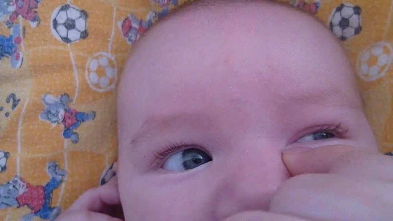 Гноятся глаза у ребенка