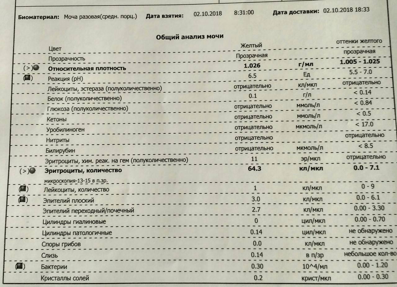 16 основных причин появления эритроцитов в моче у ребёнка