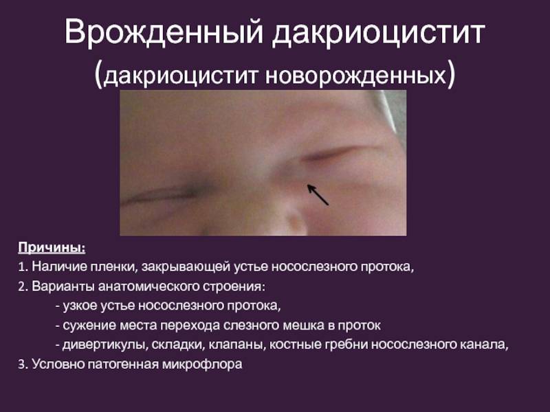 По каким причинам новорожденный ребенок закатывает глаза, диагностика и лечение