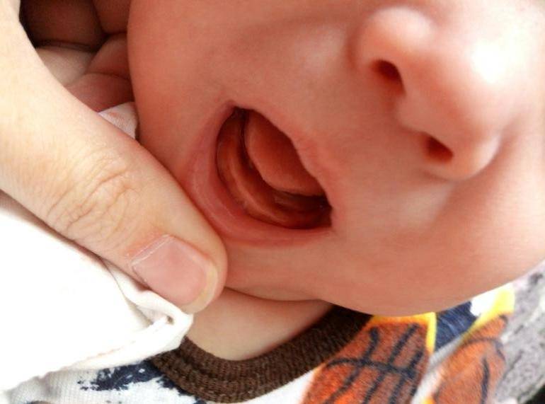 Почему у ребенка текут слюни: причины обильного слюноотделения у детей от 2 месяцев до 3 лет