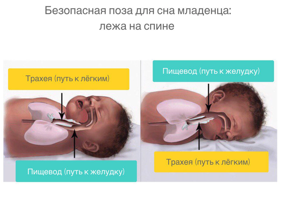 Почему грудным детям нельзя. Положение для сна новорожденных. Правильное положение для сна новорожденного. Положение сна грудничка. Нормальное положение новорожденного во сне.