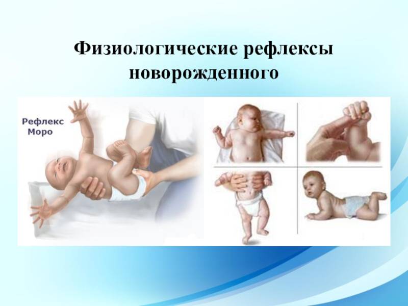 Таблица врожденных безусловных рефлексов новорожденных: видео и способы проверки