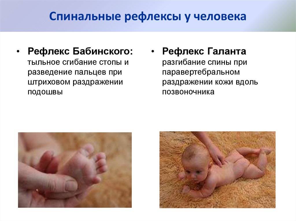 Рефлекс бабинского - что нужно знать