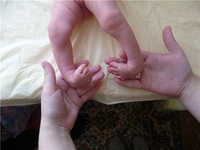 Ноги и руки холодные при температуре у ребенка: причины, опасность симптома, помощь малышу