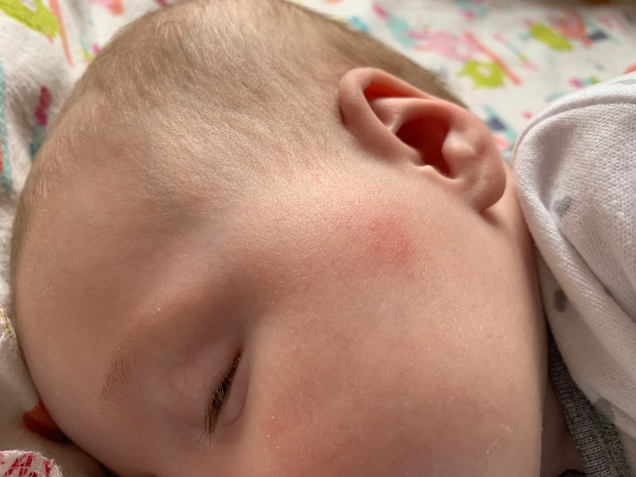 Аллергическая сыпь у новорожденного: причины, симптомы и лечение