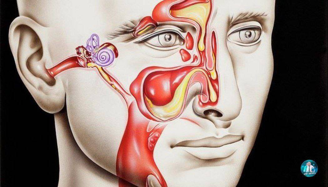 Простуда головы ушей. Анатомия гайморовой пазухи человека. Пазухи носа анатомия гайморит. Евстахиева труба и гайморова пазуха.