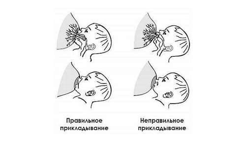 Лактостаз: как помочь? - статьи - клиника «c нуля» (здоровая семья)