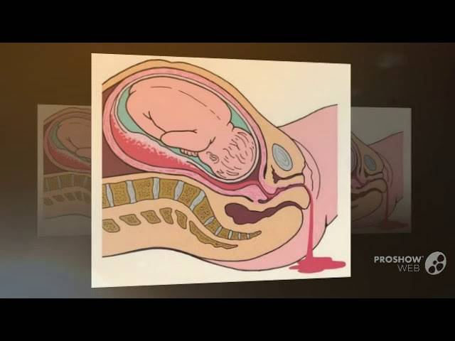 Признаки беременности при гв: симптомы и признаки без месячных