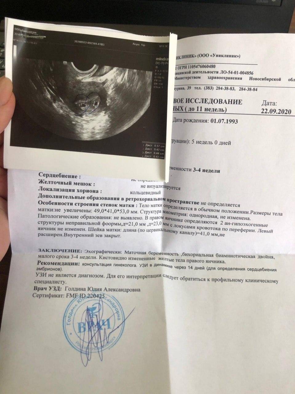 Узи при беременности — сроки проведения и особенности процедуры • центр гинекологии в санкт-петербурге