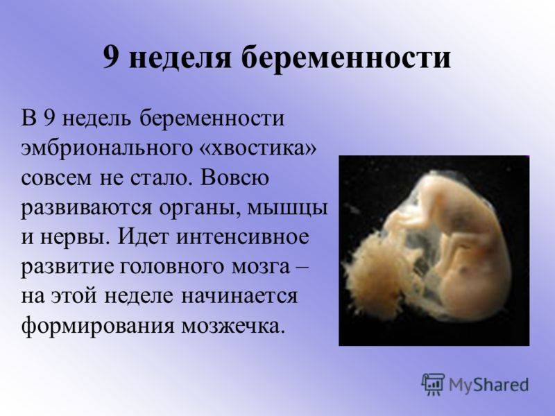 9 неделя беременности. календарь беременности   | материнство - беременность, роды, питание, воспитание