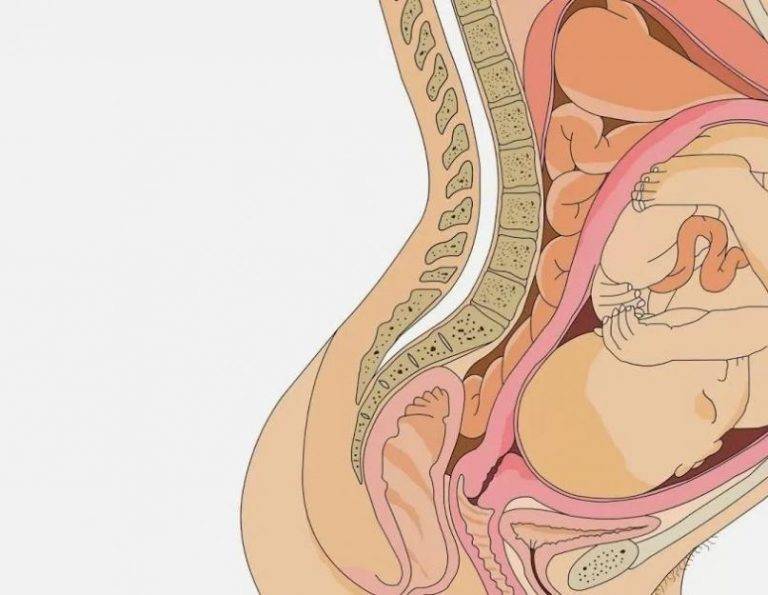 Геморрой при беременности: надо ли лечить?