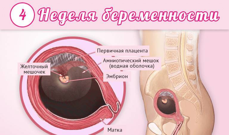 Беременность 4 недели описание и фото — евромедклиник 24
