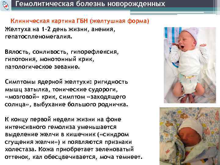 Что такое гемолитическая болезнь новорожденных