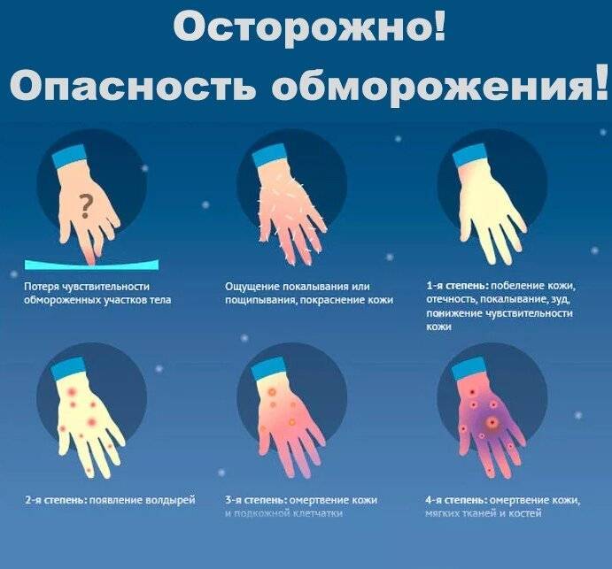 Холодовая травма, ее виды - учебный центр дополнительного профессионального образования