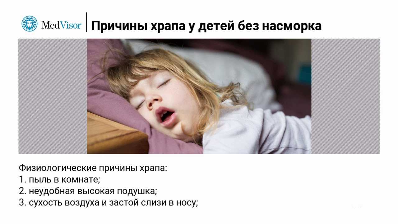 Почему ребенок храпит во сне?