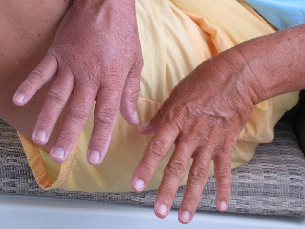 Болят кисти рук при беременности | клиника "здравствуй!"